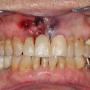 동의치과기공소 이미지