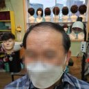 영등포 가발 두해증모 두해가발 추천하고 또 추천드려요