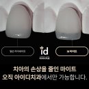 아이디치과기공소 이미지