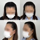 인천 두피문신: 나만의 헤어라인을 완성하는 스마트한 선택