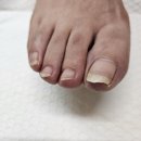 주향교회 | 대전레푸스중리점 다솜네일에서 병원에서 내성발톱진단을 받은 파고드는발톱관리를 전문적으로 받아보세요~