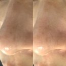 제주 서귀포피부관리 1회만으로 눈에 보이는 효과 프리미엄 관리샵 아이세라피아로마