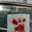 덴토피아치과 네이버블로그