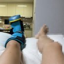 발목 인대(전거비, 종비, 후거비) 완전 파열 청주 윈윈정형외과 진단 후기/ 입원 준비물 꿀팁
