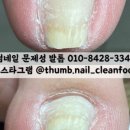 블링핑거스 이미지