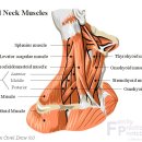 사경[斜頸, torticollis] 이미지