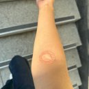 고양시청 덕양구보건소 이미지