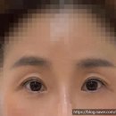 블랙브로우