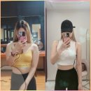 빠른병원 | 김포지방분해주사 효과 빠른 부천주말병원 365mc 팔뚝살주사 솔직 후기