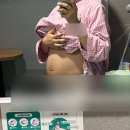 차엔(주) | 대구동구파티마병원 제왕절개 출산 후기 (수술2일차~퇴원까지)
