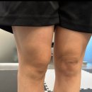 웰니스짐 | [수성구pt]단 1회만에 변화?! 웰니스짐 학생 PT 체형교정 후기