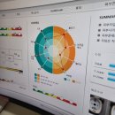 오투 | 평택에스테틱 에멜리아에서 오투덤 산소테라피 후기