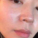 레이져 | 서울대입구역피부관리 엑스터프로 모공레이져 후기 (효과직빵)