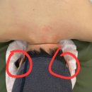 알포유수테라피