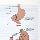 소화성 가정 이미지