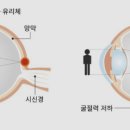 아이패밀리 안경원(구로디지털점) 이미지
