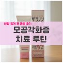 사촌 | 모공각화증 치료 루틴, 사촌동생이 효과 본 보습제 후기