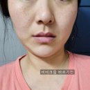 블랑스킨케어 | 매일쓰는 기초화장품 쟝블랑 달팽이 점액 스킨케어세트 사용후기
