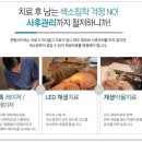 고운얼굴피부과의원 네이버블로그