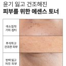 케이엠피헬스케어매니지먼트 | 에센스토너 하나로 끝내는 여름철 수분광 케어 “비로체broche쌀윤광토너” 쌀토너 사용 찐 후기