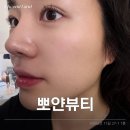 대구 북구 칠곡 웨딩 피부관리 뽀얀뷰티 에스테틱샵