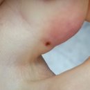 한국한센복지협회부설의원 이미지