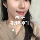 2585 | 양재역 피부과 쥬베룩 스킨부스터 효과 시기 후기