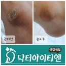 허네일 이미지