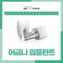 연합치과 네이버블로그