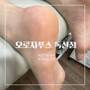 오로풋케어피부관리샵 | [오로지푸스 독산점] 여름맞이 맨발도 자신있게 발각질 관리