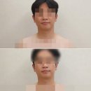 Body Atelier | 울산 피부관리 아뜰리에드스킨 LTR 스킨케어 솔직후기