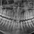 휴아치과의원 이미지