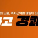 튜브락 이미지