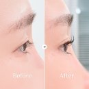 관성빌딩 | 맞춤 상담, 결과 찐만족x200 | 스튜디오 래아 | 네이버 할인 + 클리닉제 샘플 증정/장단점/상담 후기