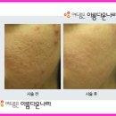 아름다운나라피부과