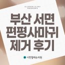 엘레슈의원 | 부산 서면 편평사마귀 제거 후기 알아보는 중이라면