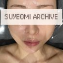 수원-2000 | 예쁘다에스테틱 고주파 리프팅 수원 피부 관리 탄력 후기 주차