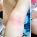 피부사랑 스킨케어 이미지