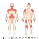 등 통증 원인,등이 아픈 이유 이미지