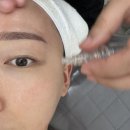 구로 천왕 피부관리 오늘the예쁨 여름철 버닝필 후기