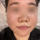 [전주 평화동 피부샵] 리유에스테틱 - 1:1로 프라이빗하게 엑소좀 관리 받은 후기