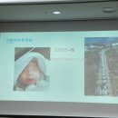 하늘빛사랑정신건강의학과의원 | [임신기록] 2025년 11월 광주 서구보건소 태교교실(정신의학과 아빠의 육아일기+부부 필라테스) 참여 후기