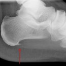 어진서부한의원 이미지