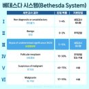 (만) 22세 소녀의 갑상선암 투병기 (1)