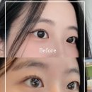 광명시술원 | 평택LED연장 맛집 데이솜뷰티