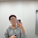 순천 블리비의원 점 뺀 후기 (내돈내산 찐후기)