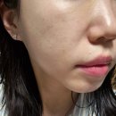 오성병원(급식실 포함) | 리투오 효과 정리 | 성분·주기·유지기간 총정리