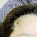 아름헤어라인 - 성남시 수정구 | 아름헤어라인