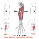 골프와 테니스 후 가운데 손가락에 생긴 통증과 부종 이미지