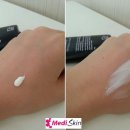 메디레스큐 이미지